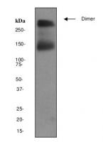 Western blot - Metabotropic Glutamate Re