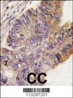 Formalin-fixed and paraffin-embedded hum