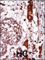 Formalin-fixed and paraffin-embedded hum