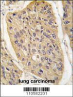 Formalin-fixed and paraffin-embedded hum