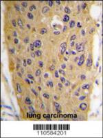 Formalin-fixed and paraffin-embedded hum