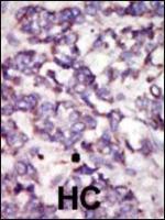 Formalin-fixed and paraffin-embedded hum