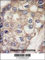 Formalin-fixed and paraffin-embedded hum