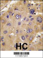 Formalin-fixed and paraffin-embedded hum