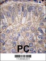 Formalin-fixed and paraffin-embedded hum