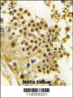 Formalin-fixed and paraffin-embedded hum