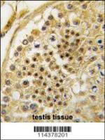 Formalin-fixed and paraffin-embedded hum