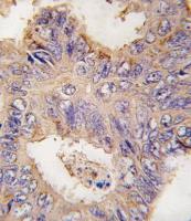Formalin-fixed and paraffin-embedded hum