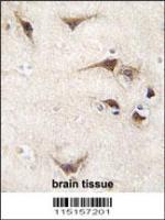 Formalin-fixed and paraffin-embedded hum