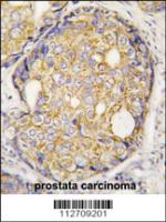 Formalin-fixed and paraffin-embedded hum