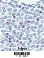 Formalin-fixed and paraffin-embedded hum