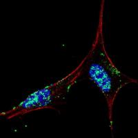 IF image of SY5Y cells stained with TA30