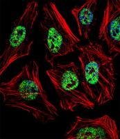 IF image of Hela cell stained with NANOG