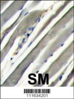 Formalin-fixed and paraffin-embedded hum