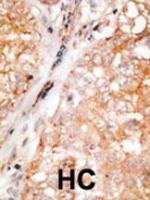 Formalin-fixed and paraffin-embedded hum