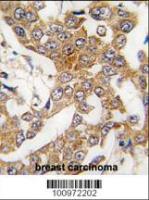 Formalin-fixed and paraffin-embedded hum