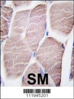 Formalin-fixed and paraffin-embedded hum