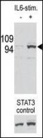 The phospho-STAT3-Ser727 Pab (Cat. #TA30