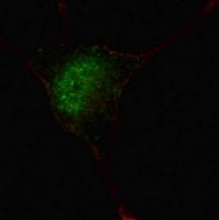 IF image of SY5Y cells stained with phos