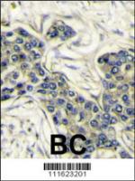 Formalin-fixed and paraffin-embedded hum