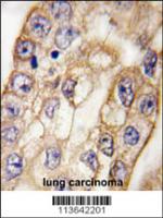 Formalin-fixed and paraffin-embedded hum