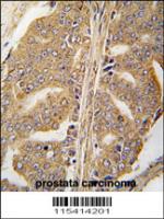 Formalin-fixed and paraffin-embedded hum