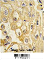 Formalin-fixed and paraffin-embedded hum