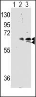 Western blot analysis of Phospho-RPS6KB1
