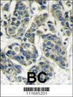 Formalin-fixed and paraffin-embedded hum