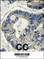 Formalin-fixed and paraffin-embedded hum