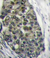 Formalin-fixed and paraffin-embedded hum