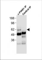 HEK293 cell extracts were prepared and i