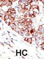 Formalin-fixed and paraffin-embedded hum