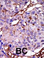 Formalin-fixed and paraffin-embedded hum