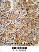 Formalin-fixed and paraffin-embedded hum