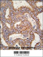 Formalin-fixed and paraffin-embedded hum