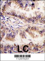 Formalin-fixed and paraffin-embedded hum