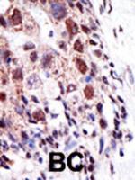 Formalin-fixed and paraffin-embedded hum