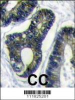 Formalin-fixed and paraffin-embedded hum