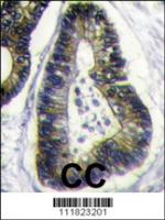 Formalin-fixed and paraffin-embedded hum