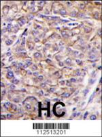 Formalin-fixed and paraffin-embedded hum