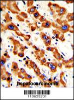 Formalin-fixed and paraffin-embedded hum