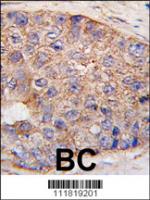 Formalin-fixed and paraffin-embedded hum