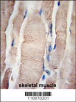Formalin-fixed and paraffin-embedded hum