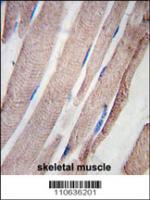 Formalin-fixed and paraffin-embedded hum