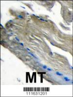 Formalin-fixed and paraffin-embedded hum