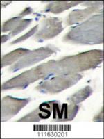 Formalin-fixed and paraffin-embedded ske
