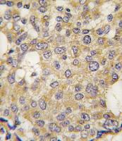 Formalin-fixed and paraffin-embedded hum