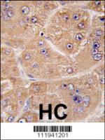 Formalin-fixed and paraffin-embedded hum