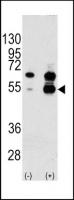 Western blot analysis of VEGF1 Antibody